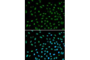 Immunofluorescence analysis of MCF-7 cells using DDB2 antibody (ABIN5970947). (DDB2 抗体)