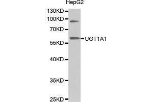 Western Blotting (WB) image for anti-UDP Glucuronosyltransferase 1 Family, Polypeptide A1 (UGT1A1) (AA 1-200) antibody (ABIN1683210) (UGT1A1 抗体  (AA 1-200))