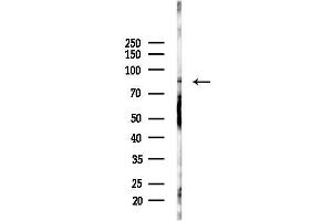 Western blot analysis of lysates from Mouse testis, using IL6R Antibody at 1/1000 dilution.