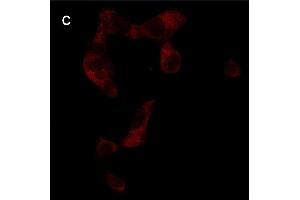 Detection of cathepsin B (CB) activity in Eca-109 cells by the CB probe. (山羊 anti-兔 IgG Antibody (FITC))