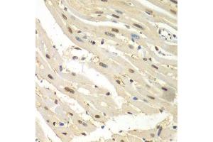 Immunohistochemistry of paraffin-embedded mouse heart using HDAC2 antibody. (HDAC2 抗体  (C-Term))