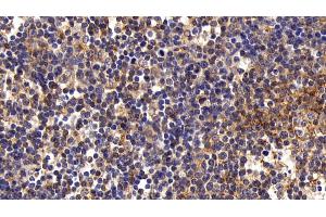 Detection of FAS in Porcine Lymph node Tissue using Polyclonal Antibody to Factor Related Apoptosis (FAS) (FAS 抗体)