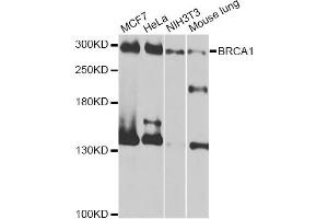Western blot analysis of extracts of various cell lines, using BRCA1 antibody (ABIN5997316) at 1/1000 dilution. (BRCA1 抗体)