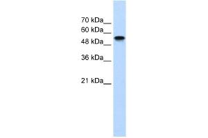 WB Suggested Anti-NR1H2 Antibody Titration:  1. (NR1H2 抗体  (N-Term))