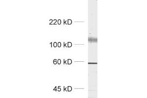dilution: 1 : 1000, sample: synaptic membrane fraction (LP1) (Kv2.2 抗体  (AA 859-873))