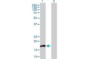 Western Blot analysis of IL20 expression in transfected 293T cell line by IL20 MaxPab polyclonal antibody. (IL-20 抗体  (AA 1-176))