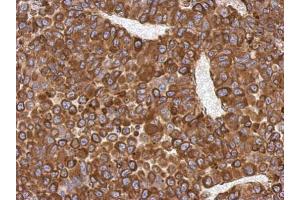 IHC-P Image Immunohistochemical analysis of paraffin-embedded PC13 xenograft, using AGR3, antibody at 1:500 dilution. (AGR3 抗体  (Center))