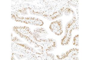 Immunohistochemistry (IHC) image for anti-Androgen Receptor (AR) (AA 1-50) antibody (ABIN7795785)