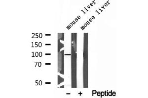 Western blot analysis of extracts of mouse liver tissue, using AGGF1 antibody. (AGGF1 抗体  (Internal Region))