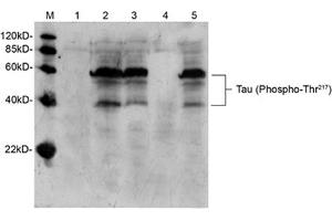 Western blot analysis of mouse brain tissue lysate using Rabbit Anti-Tau (Phospho-Thr217) Polyclonal Antibody (ABIN398308) Lane 1: Primary antibody negative controlLane 2: Rabbit Anti-Tau (Phospho-Thr217) Polyclonal AntibodyLane 3: Rabbit Anti-Tau (Phospho-Thr217) Polyclonal Antibody pre-incubated with non-phoshpo-peptideLane 4: Rabbit Anti-Tau (Phospho-Thr217) Polyclonal Antibody pre-incubated with phoshpo-peptideLane 5: Rabbit Anti-Tau (Phospho-Thr217) Polyclonal Antibody pre-incubated with generic phospho-threonine containing peptideSecondary antibody: Goat Anti-Rabbit IgG (H&L) [HRP] Polyclonal Antibody (ABIN398323) The signal was developed with LumiSensorTM HRP Substrate Kit (ABIN769939) (tau 抗体  (pThr217))