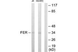 Western blot analysis of extracts from Jurkat/HuvEc cells, using FER Antibody. (FER 抗体  (AA 766-815))
