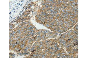 Immunohistochemistry (IHC) image for anti-Solute Carrier Family 16, Member 1 (Monocarboxylic Acid Transporter 1) (SLC16A1) antibody (ABIN2431636) (SLC16A1 抗体)