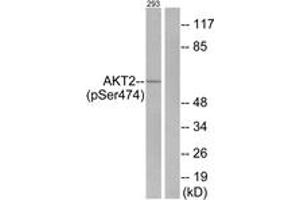 Western blot analysis of extracts from 293 cells treated with EGF 200ng/ml 30', using Akt2 (Phospho-Ser474) Antibody. (AKT2 抗体  (pSer474))