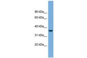 Image no. 1 for anti-Crystallin, mu (CRYM) (AA 71-120) antibody (ABIN6743607) (CRYM 抗体  (AA 71-120))