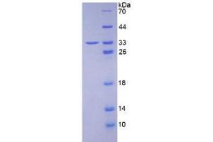 SDS-PAGE analysis of Human HABP1 Protein. (C1QBP 蛋白)