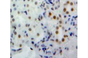 Used in DAB staining on fromalin fixed paraffin-embedded Kidney tissue (NUP160 抗体  (AA 11-206))