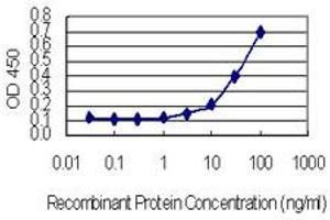 Detection limit for recombinant GST tagged HARS is 0. (HARS1/Jo-1 抗体  (AA 1-96))