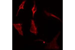 ABIN6275088 staining  Hela cells by IF/ICC. (MARCH3 抗体  (Internal Region))