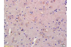 Formalin-fixed and paraffin embedded rat brain labeled with Anti-CNGA2 Polyclonal Antibody, Unconjugated (ABIN677258) at 1:200, followed by conjugation to the secondary antibody and DAB staining (CNGA2 抗体  (AA 155-250))