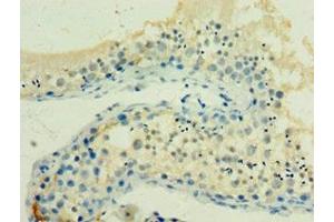 Immunohistochemistry of paraffin-embedded human testis tissue using ABIN7154927 at dilution of 1:100 (HSPA2 抗体  (AA 400-639))
