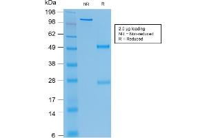 SDS-PAGE Analysis Purified CEA Mouse Recombinant Monoclonal Antibody (rC66/1009). (Recombinant CEACAM5 抗体)
