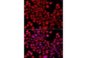 Immunofluorescence analysis of A549 cell using RARG antibody.