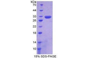 SDS-PAGE (SDS) image for Ring Finger Protein 112 (RNF112) (AA 73-322) protein (His tag) (ABIN1980892)