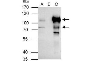 Immunoprecipitation (IP) image for anti-B-Cell CLL/lymphoma 6 (BCL6) (Internal Region) antibody (ABIN2855012)