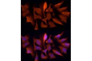 Immunofluorescence analysis of U2OS cells using PSMC5 Rabbit mAb (ABIN7269585) at dilution of 1:50 (40x lens). (PSMC5 抗体)