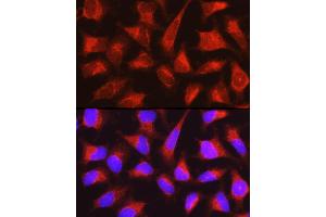 Immunofluorescence (IF) image for anti-phosphorylase, Glycogen, Liver (PYGL) (AA 1-280) antibody (ABIN6146525)