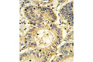 Immunohistochemistry (IHC) image for anti-Suppressor of Cytokine Signaling 1 (SOCS1) antibody (ABIN3003913) (SOCS1 抗体)