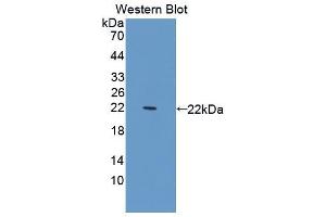 Western blot analysis of the recombinant protein. (SERPING1 抗体  (AA 148-270))