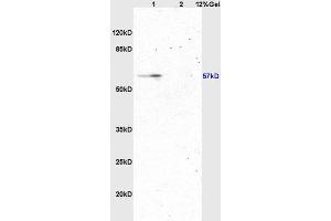 Lane 1: rat brain lysates Lane 2: rat kidney lysates probed with Anti ATG13 Polyclonal Antibody, Unconjugated (ABIN750313) at 1:200 in 4 °C. (ATG13 抗体  (AA 51-150))