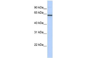 WB Suggested Anti-RNMT Antibody Titration:  0. (RNMT 抗体  (C-Term))