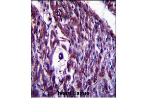 GED4B Antibody (Center) (ABIN657370 and ABIN2846417) immunohistochemistry analysis in forlin fixed and paraffin embedded hun heart tissue followed by peroxidase conjugation of the secondary antibody and DAB staining. (MAGED4B 抗体  (AA 328-357))
