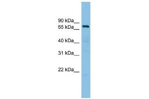 AKAP10 antibody used at 1 ug/ml to detect target protein. (AKAP10 抗体)