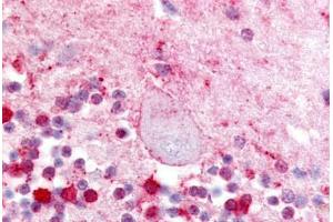 Human Brain, Cerebellum  (formalin-fixed, paraffin-embedded) stained with LPAR5 antibody ABIN213472 at 10 ug/ml followed by biotinylated goat anti-rabbit IgG secondary antibody ABIN481713, alkaline phosphatase-streptavidin and chromogen. (LPAR5 抗体  (Extracellular Domain))