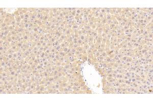 Detection of LDLR in Mouse Liver Tissue using Polyclonal Antibody to Low Density Lipoprotein Receptor (LDLR) (LDLR 抗体  (AA 263-509))