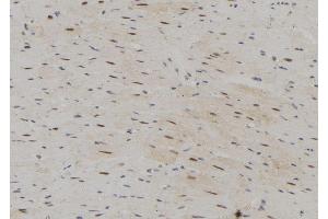 ABIN6273076 at 1/100 staining Rat heart tissue by IHC-P. (SRP68 抗体  (C-Term))