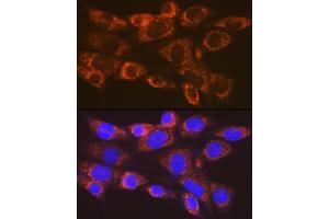 Immunofluorescence analysis of NIH-3T3 cells using  Rabbit mAb (ABIN7265479) at dilution of 1:100 (40x lens). (ARF1 抗体)
