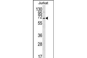PSL1 Antibody (N-term) 12400a western blot analysis in Jurkat cell line lysates (35 μg/lane). (PSAPL1 抗体  (N-Term))