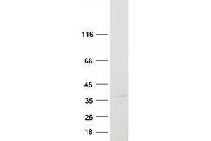 Western Blotting (WB) image for Leucine Rich Repeat Containing 10 (LRRC10) protein (Myc-DYKDDDDK Tag) (ABIN2724894)
