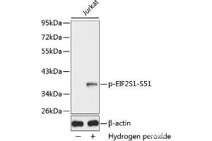 Western blot analysis of extracts from Jurkat cells using Phospho-eIF2α(S51) Polyclonal Antibody. (EIF2A 抗体  (pSer51))