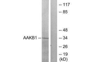 Western Blotting (WB) image for anti-Protein Kinase, AMP-Activated, beta 1 Non-Catalytic Subunit (PRKAB1) (N-Term) antibody (ABIN1850404) (PRKAB1 抗体  (N-Term))