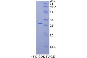 SDS-PAGE analysis of Human MCAM Protein. (MCAM 蛋白)
