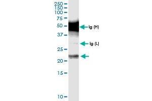 Immunoprecipitation of CENPN transfected lysate using anti-CENPN MaxPab rabbit polyclonal antibody and Protein A Magnetic Bead , and immunoblotted with CENPN MaxPab rabbit polyclonal antibody (D01) . (CENPN 抗体  (AA 1-204))