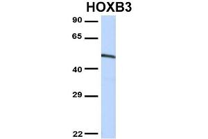 Host:  Rabbit  Target Name:  CCNT1  Sample Type:  MCF7  Antibody Dilution:  1. (Cyclin T1 抗体  (N-Term))