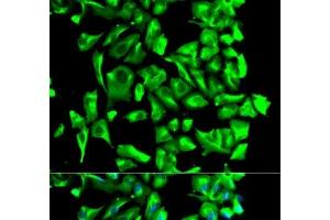 Immunofluorescence analysis of U2OS cells using HSP90AB1 Polyclonal Antibody (HSP90AB1 抗体)