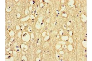 Immunohistochemistry of paraffin-embedded human brain tissue using ABIN7168091 at dilution of 1:100 (Riboflavin Kinase 抗体  (AA 1-154))