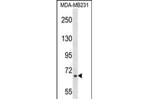 ZNF44 Antibody (N-term) (ABIN1539529 and ABIN2850156) western blot analysis in MDA-M cell line lysates (35 μg/lane). (Zinc Finger Protein 44 抗体  (N-Term))